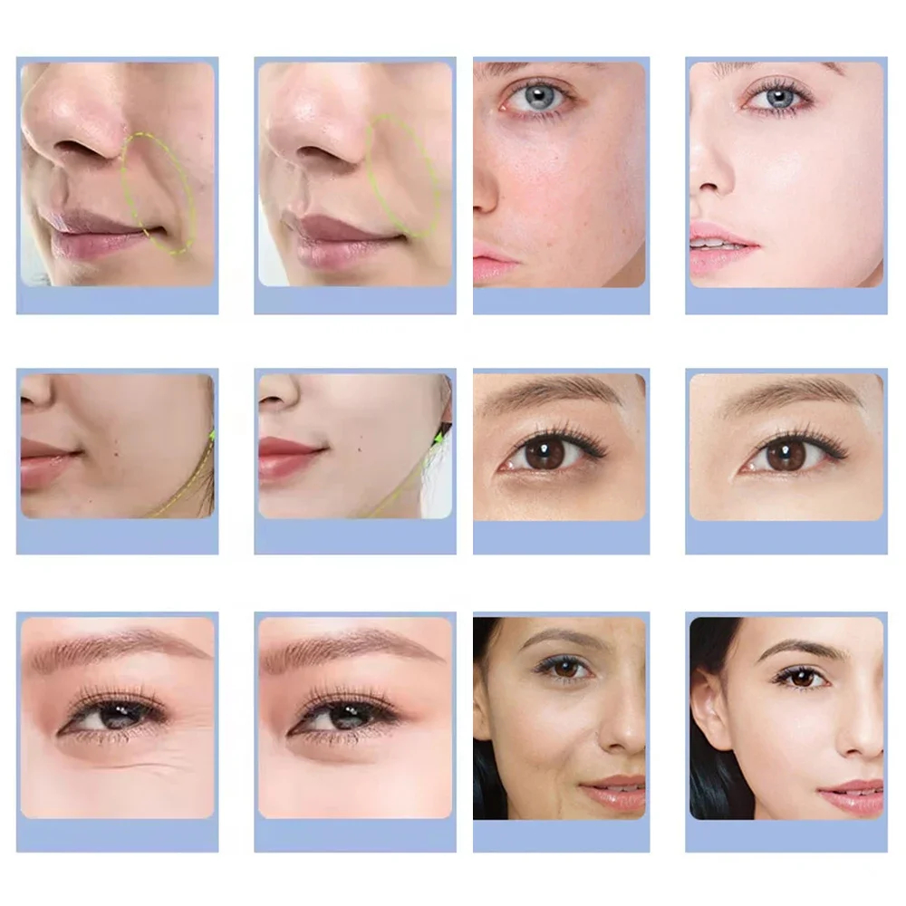 7 Types Facial CO2 Oxygen Bubb - Spa Y Wellness recension och pris